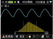 生物信息监测仪tm-2571 / tm-2572（重要箱）基本屏幕2张图像