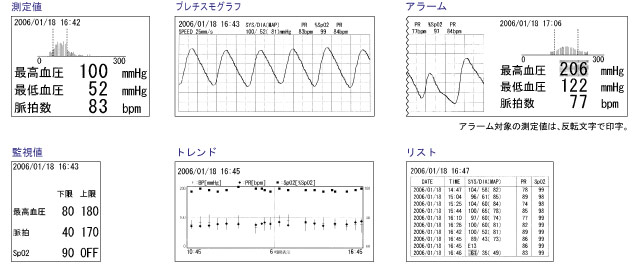 生物识别信息监视器tm  -  2571 / tm  -  2572（重要盒）打印打印示例图像